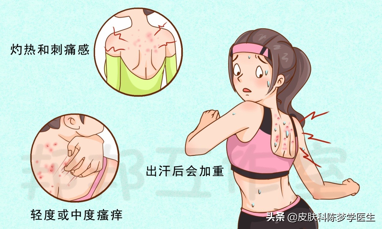 痘痘始终不好，小心是马拉色菌惹的祸
