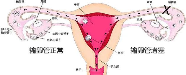 输卵管是个什么器官呢