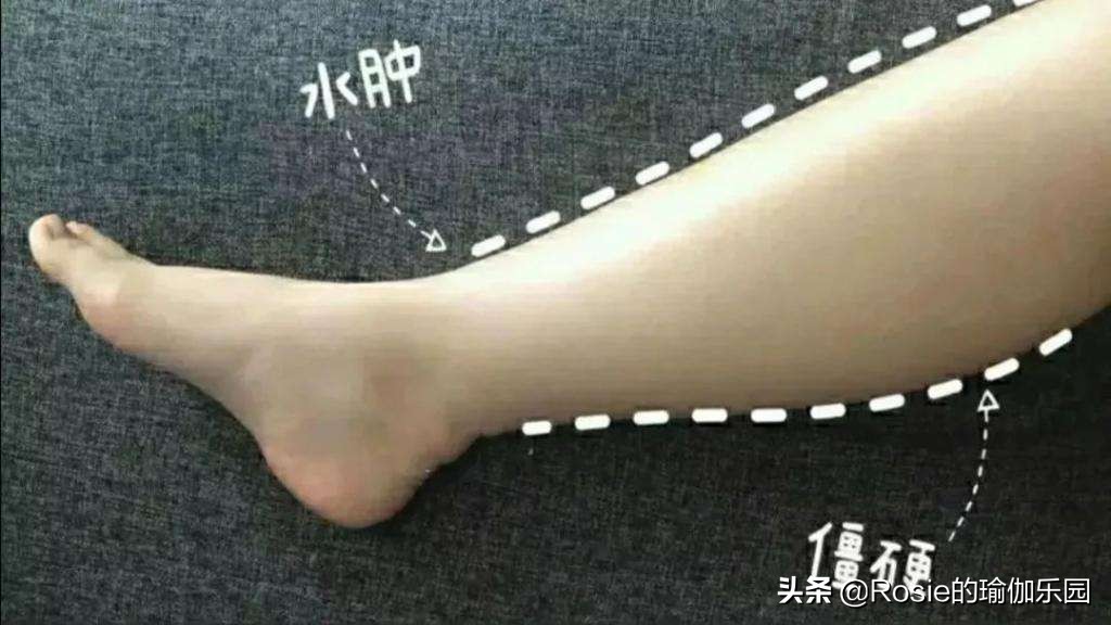 萝卜腿不敢穿小黑裙？最全瘦小腿套餐，一周拯救小腿粗恣意穿