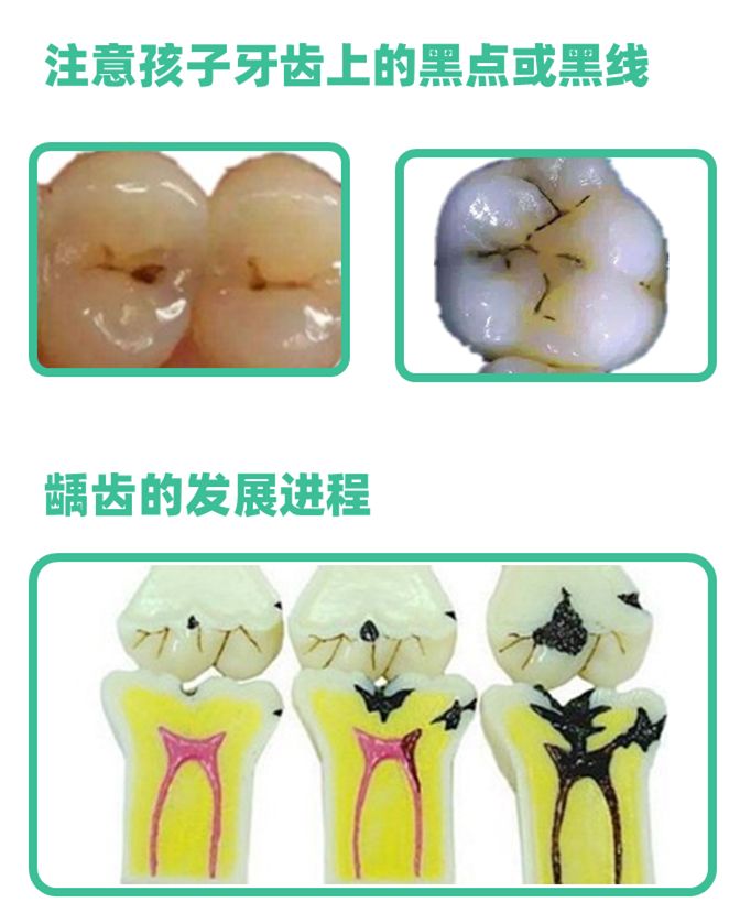 孩子身上出现这些颜色，是健康警报，却总被忽视