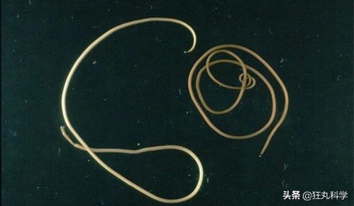 触角中的寄生虫已经能操控蜗牛身体