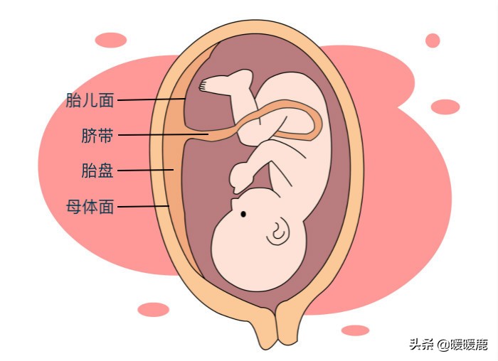 新生儿如何护理脐带，脐带护理注意什么，宝宝有脐疝怎么办