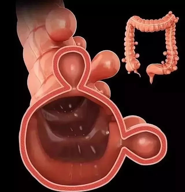 人的肠子真实图片
