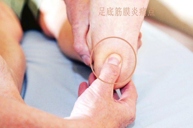 被足底筋膜炎折磨的早上不敢下地，检查发现跟骨骨刺，该如何是好