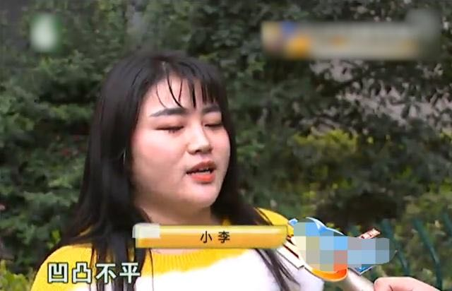 女子花50000元做腿部抽脂手术，如今怎么样了？看完不敢做