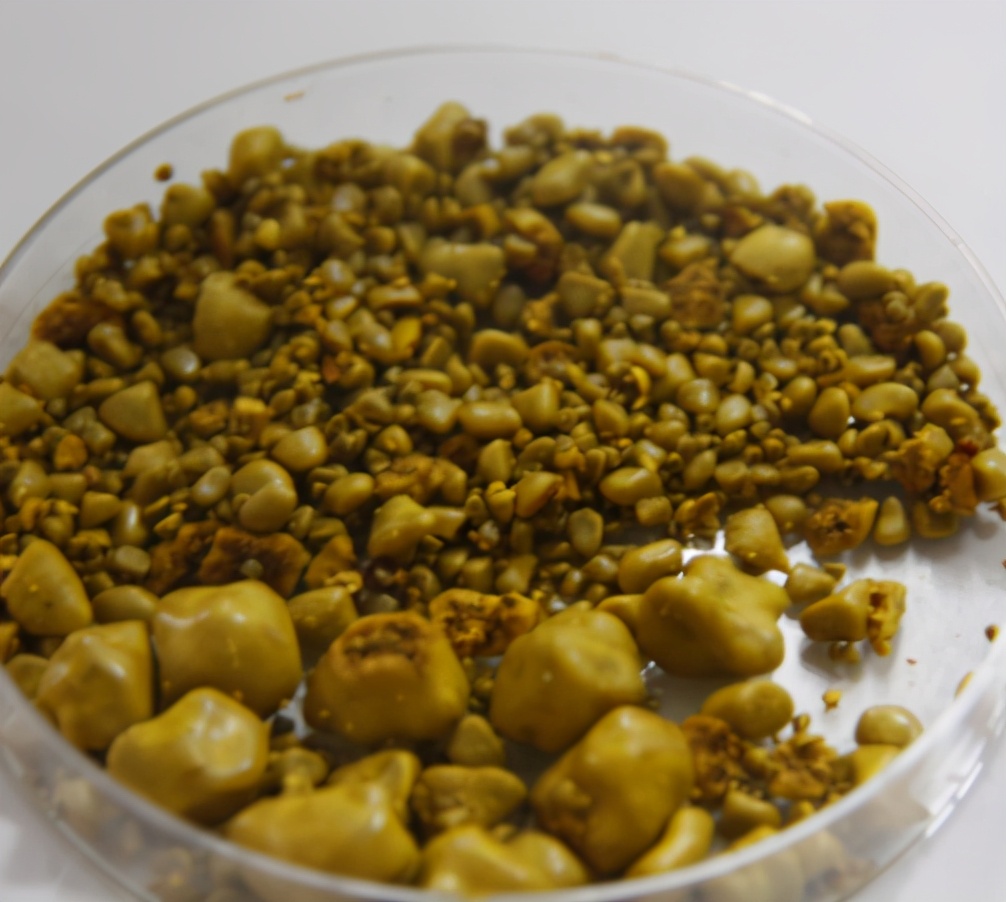 胆囊里为什么会长结石?哪些人群更容易被它盯上!一文给你讲清楚