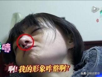 科普：隆鼻失败后怎么修复呢？