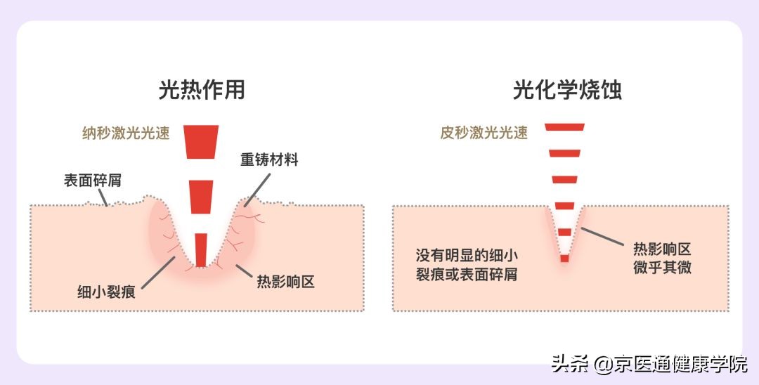 皮秒拿走的是「斑点」，还是你的不自信？