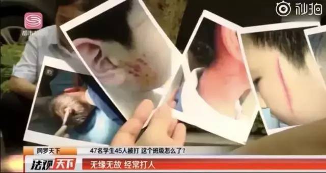 8岁女孩被同班男同学铅笔戳脚背，险些致残！学生家长透露更多恐怖细节