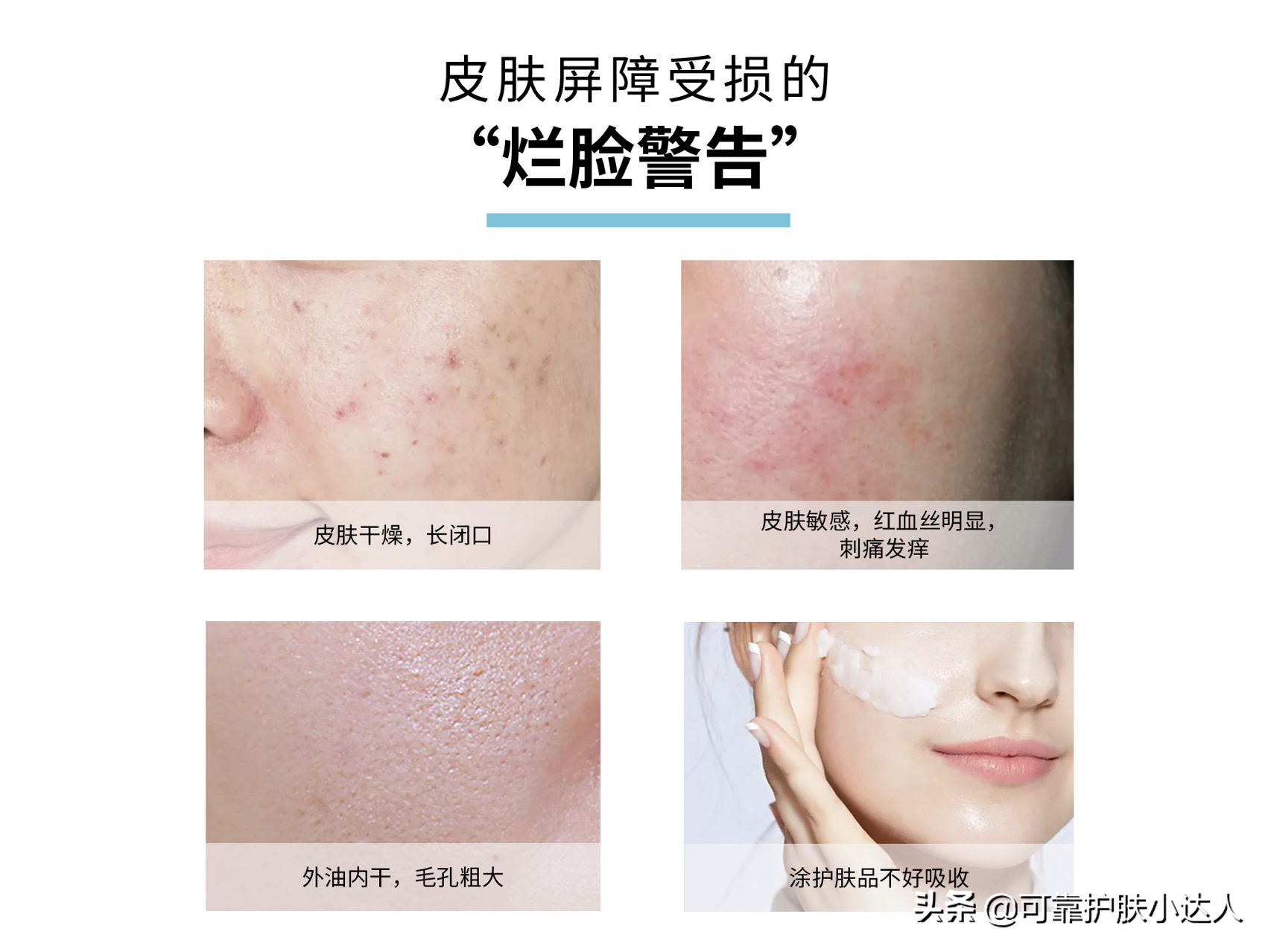 今日分享修复肌肤屏障，改善各种肌肤问题的第一步