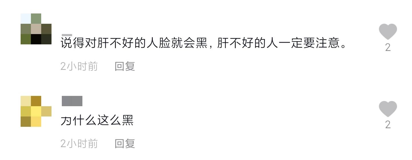 61岁齐秦近况曝光！苹果肌僵硬黑到认不出，商演不断不服老