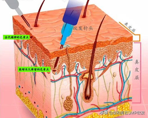 简单易懂！一篇图文让你快速了解什么是纹发