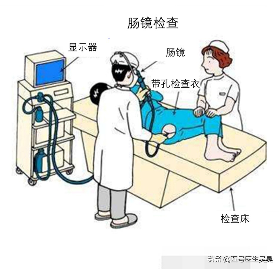 消化系统出了问题，我们都可能会做哪些检查？因病制宜才能诊断好