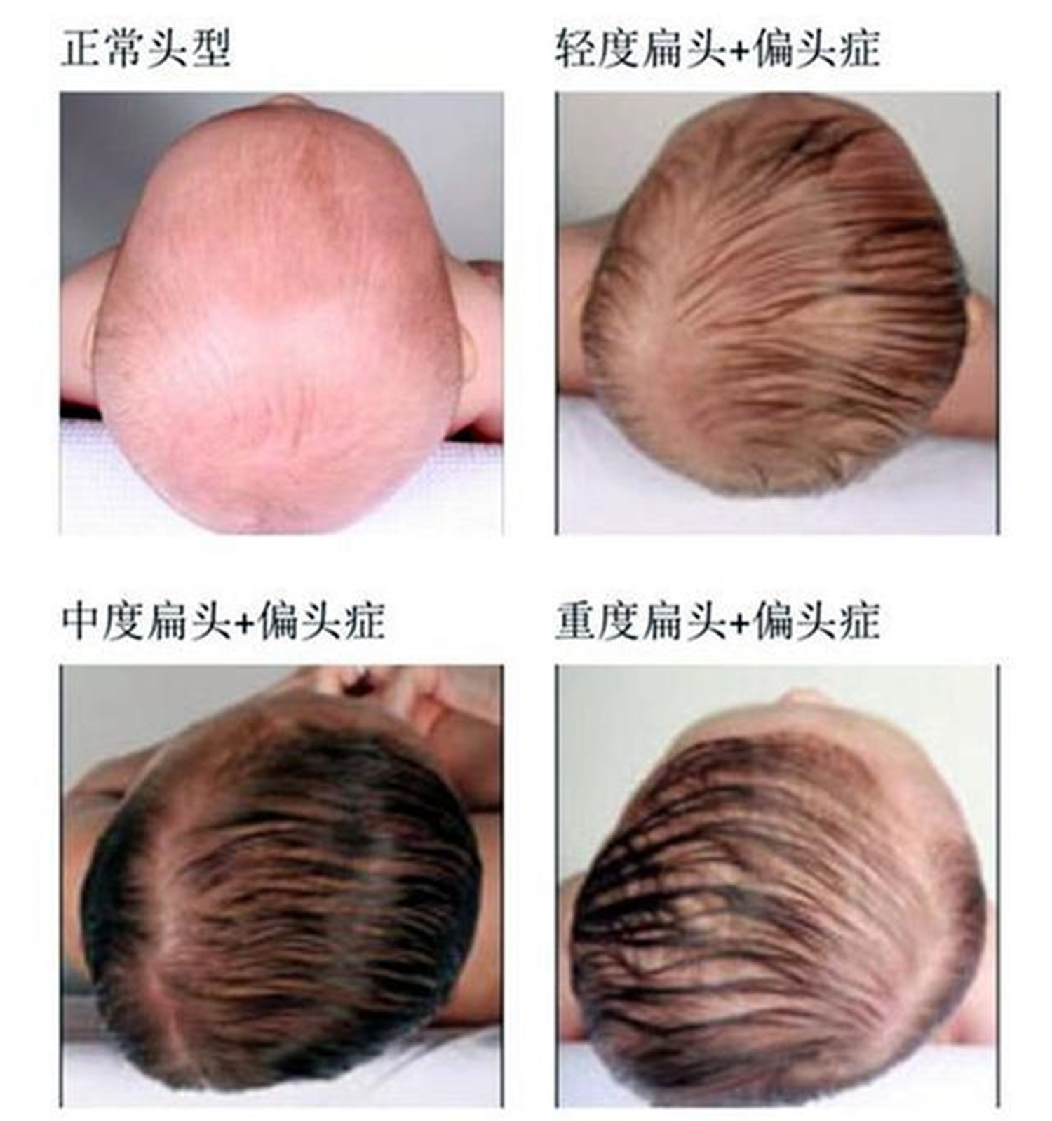 颜值中最突出的就是完美的头骨,完全不挑发型,即便贴头皮也不影响颜值