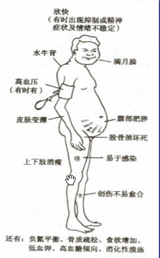 1岁内的浮肿、大量蛋白尿等该如何诊疗？