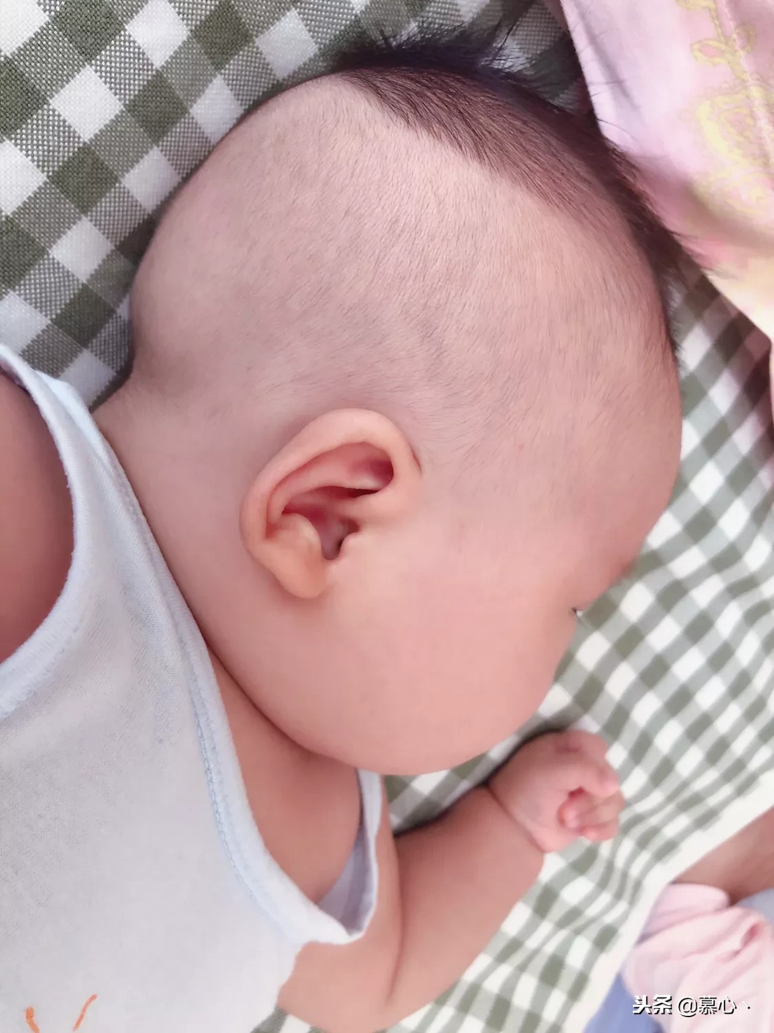 婴儿后脑勺有凹陷（婴儿的头总是偏向一侧有问题吗）-幼儿百科-魔术铺