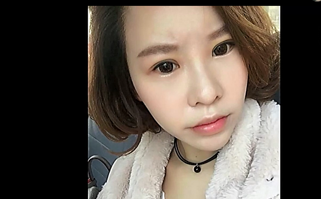 赴韩整容失败示威,赴韩整容失败视频
