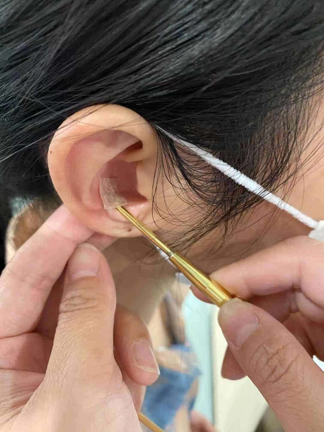 "6月8日,来凤(化名)阿姨兴势冲冲的冲进武汉市武昌医院中医科医生办公