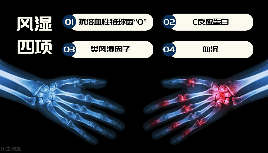 关节痛去医院，医生让查风湿四项，有什么作用？