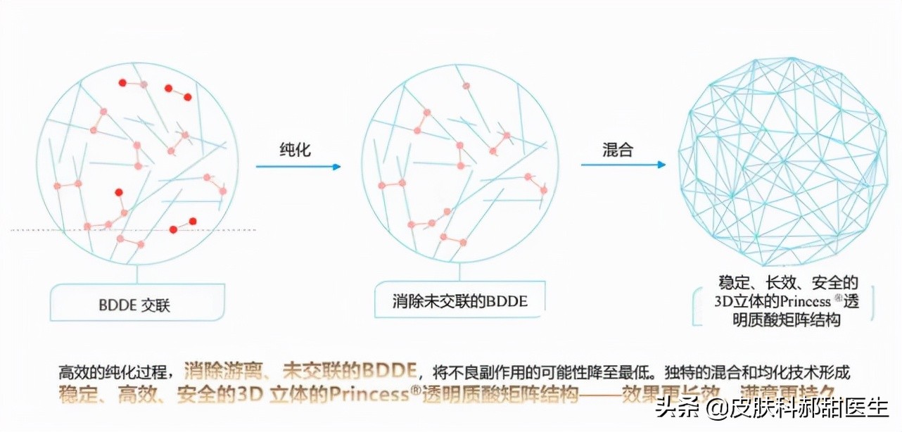 填充玻尿酸容易网红假脸？这支公主同款玻尿酸了解一下