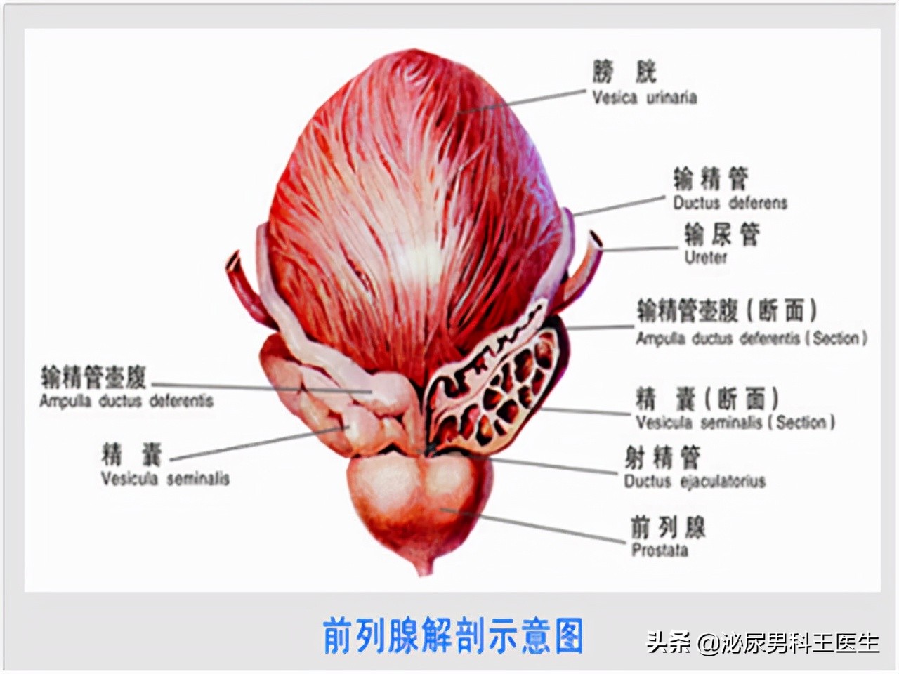 前列腺鈣化對健康有影響嗎?可否治療?是否是可逆轉治療啊?