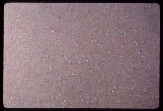 为了不伤害宝宝,一定要分清楚痱子粉与爽身粉