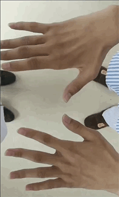 17岁少年手无力肌萎缩,小心罕见"平山病"