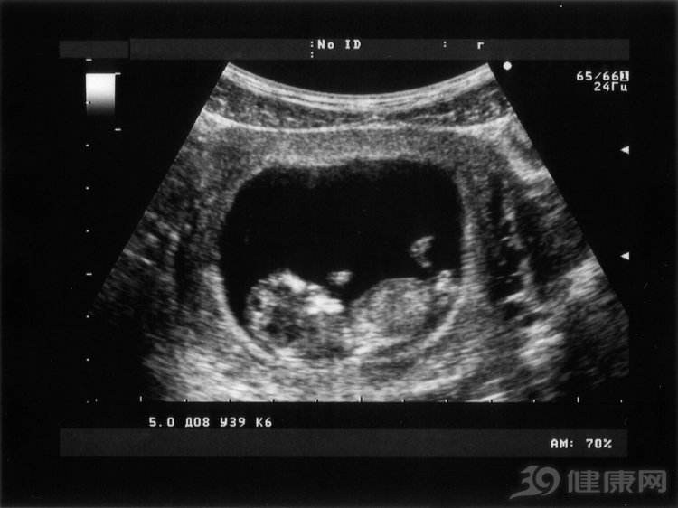 什么是阴式B超，有什么用？有5类人不适合做，看看是不是你