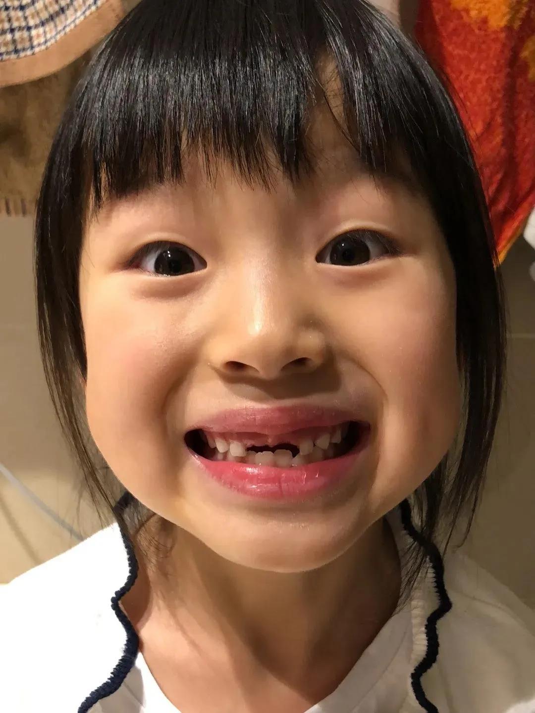 关于儿童掉牙的说说(儿童掉牙朋友圈说说) _晶羽文学网
