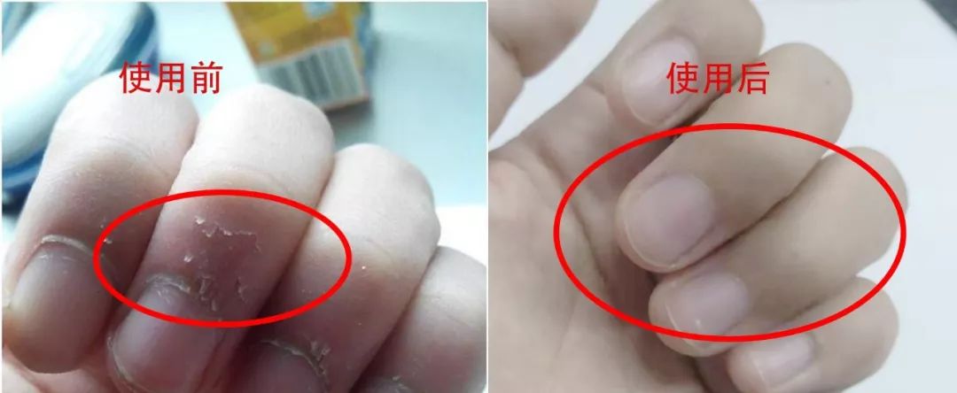 手纹深干燥、粗糙真显老！这支法国“换皮护手霜”，拯救干燥皱纹