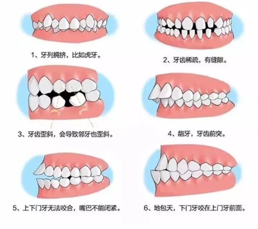 关于儿童口腔正畸，大家最关心的18个问题