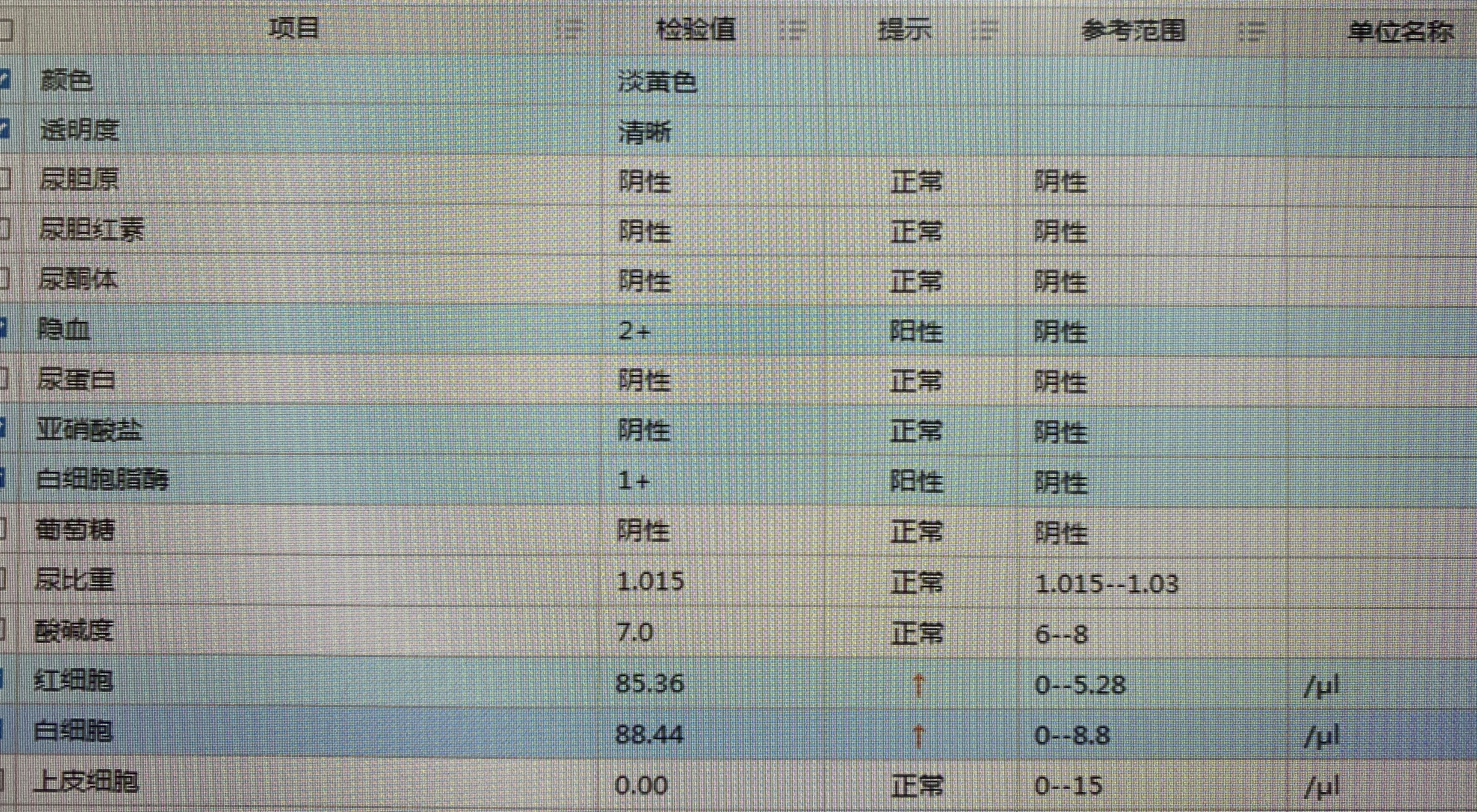血尿以为是肾病，去了肾内科被推到泌尿外科！如何自我判断？