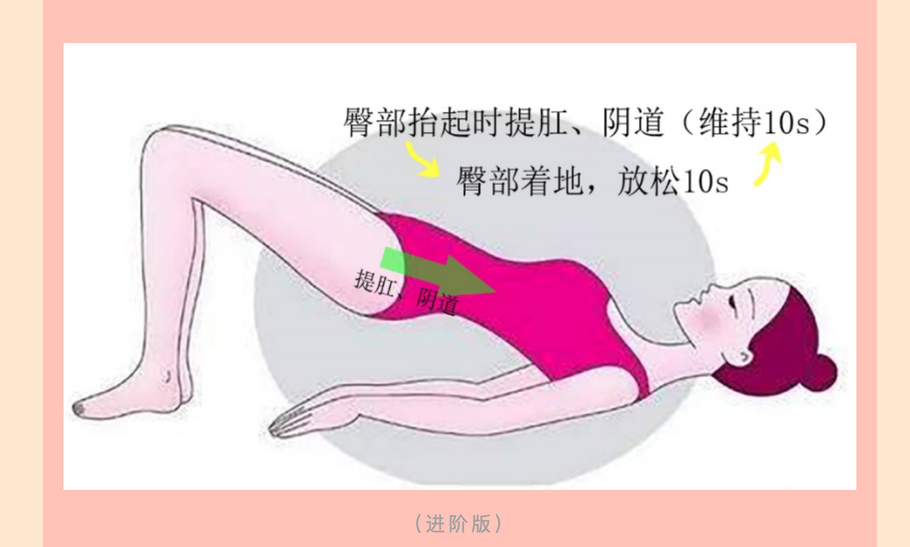 产后小腹总有下坠感，要警惕子宫脱垂啦