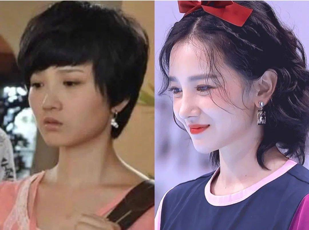 都说整容是娱乐圈“大忌”，而这10位明星，却因整容走向人生巅峰