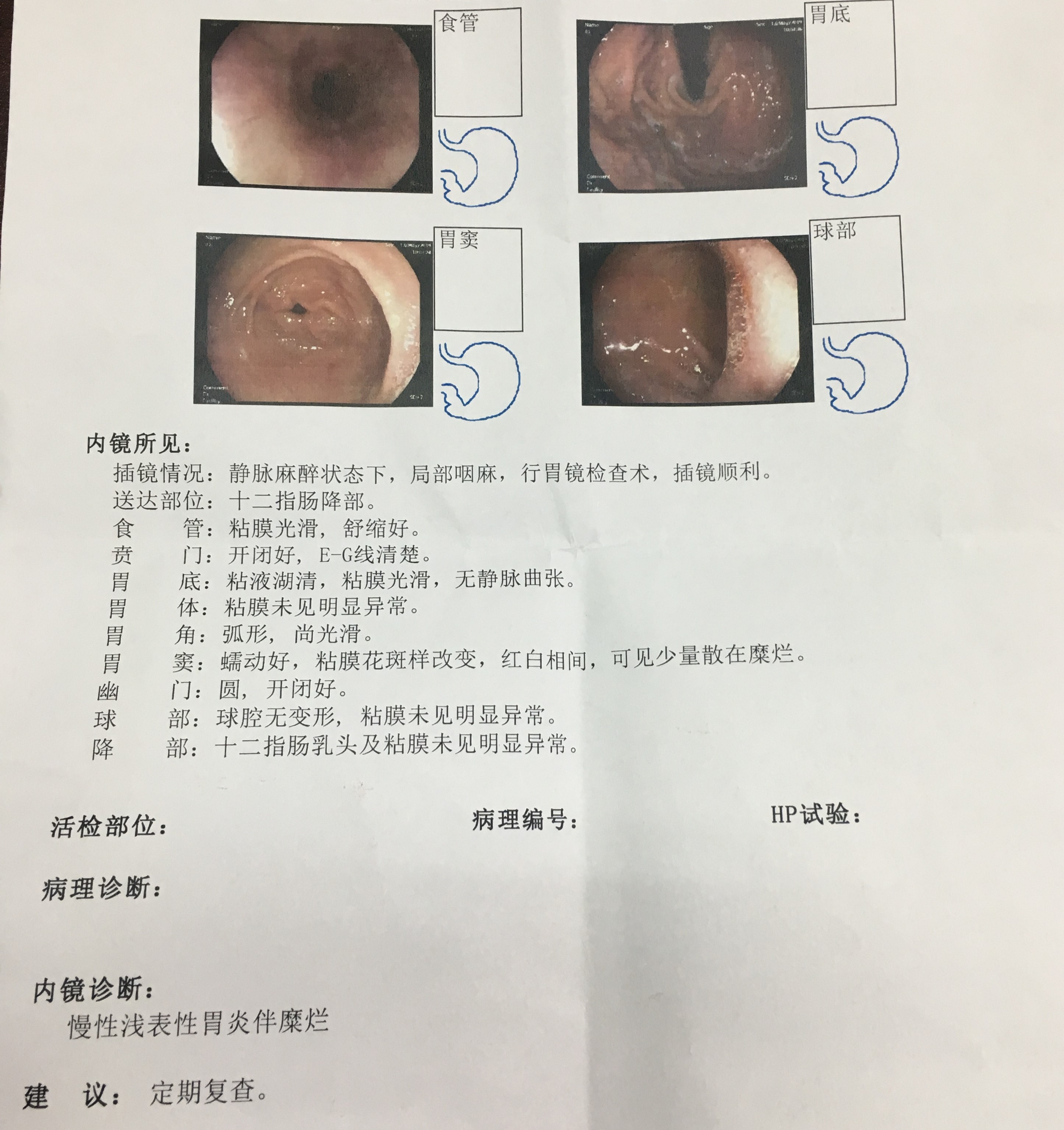 慢性非萎缩性胃炎伴糜烂的治疗方案与日常护理方法