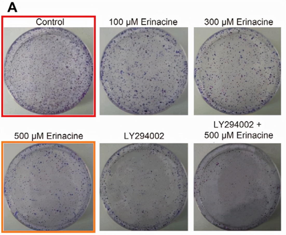 华北理工大学附属医院发表的SCI因图片疑似与他人文章重复遭质疑