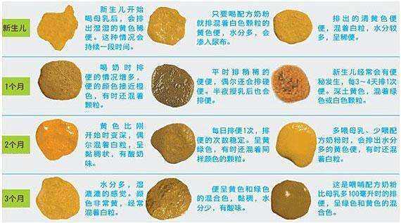 宝宝正常的大便是怎样的?