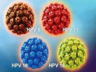 HPV感染可怕吗？