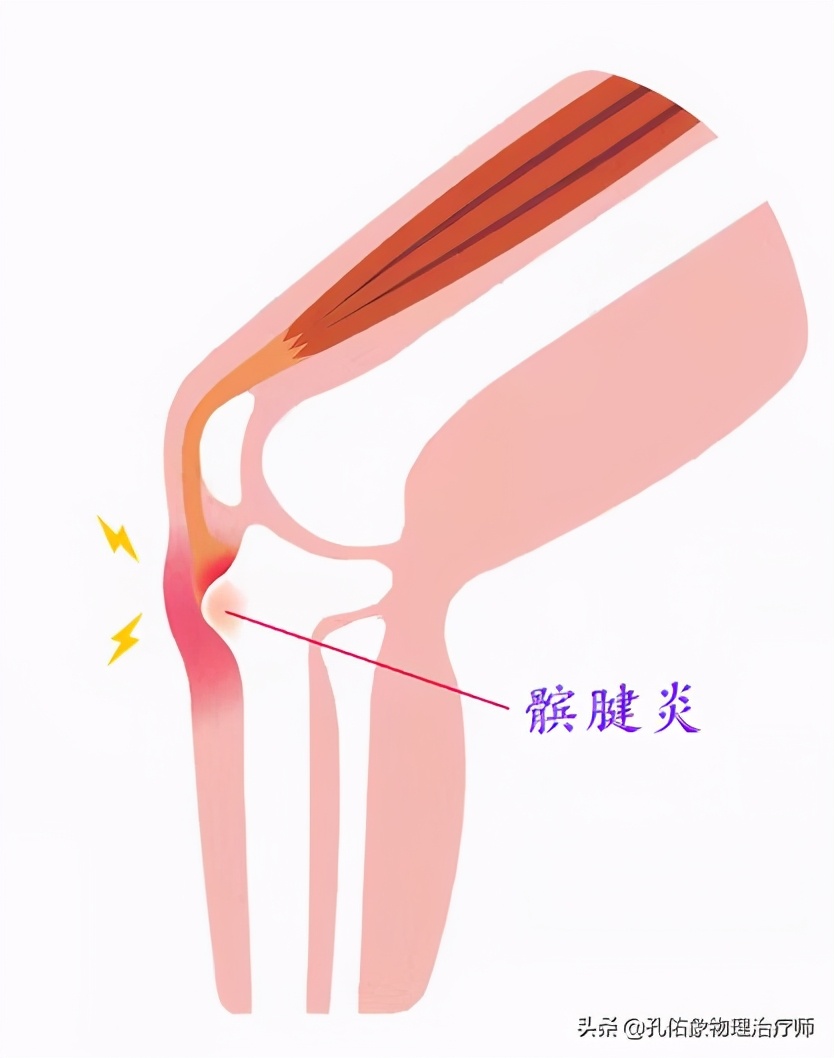 膝关节在下蹲、上下楼梯疼，还会响，为何？盘点6个原因，请收藏