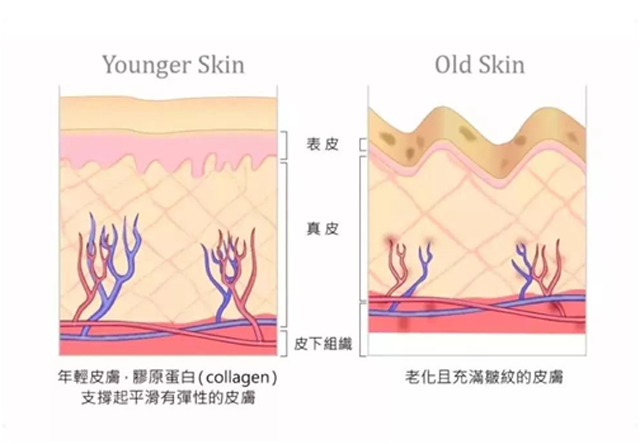 注射、线雕、拉皮、超声刀怎么选？| 北大教授张宗学