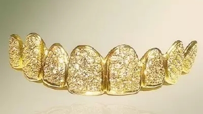 牙齿奇闻趣事——黄金和钻石打造假牙