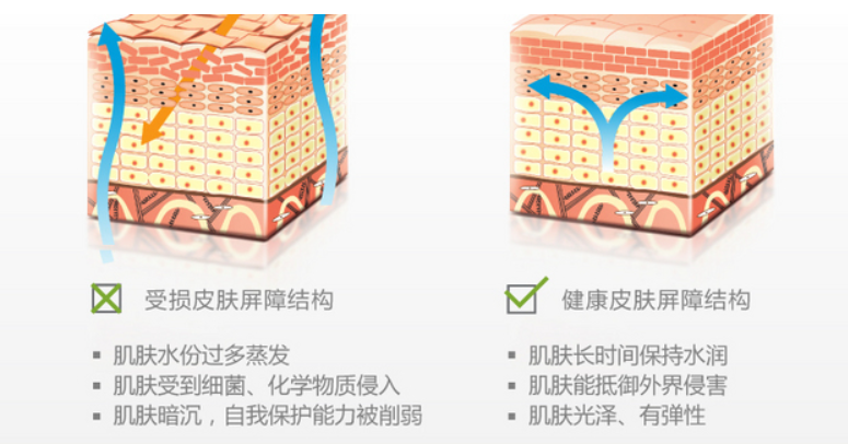皮肤瘙痒、泛红、干燥怎么办？发现问题、“对症下药”才有效