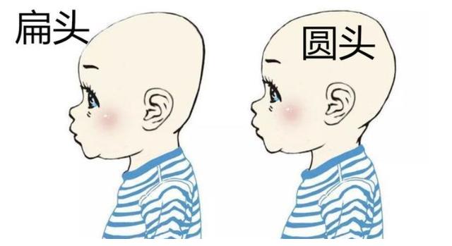 婴儿后脑勺骨头凸起图(宝宝的扁头是天生的) - 乐宝宝贝