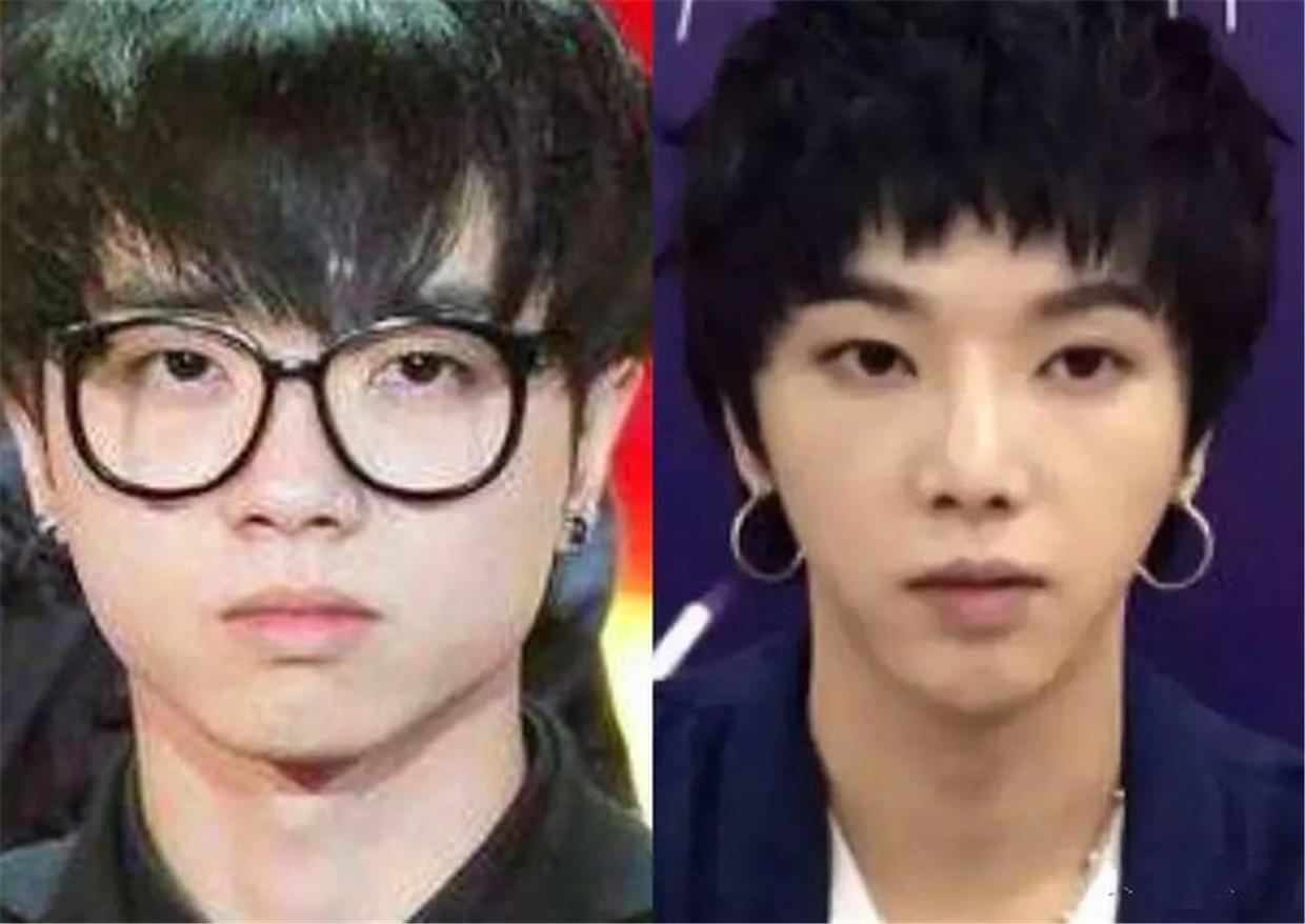 都说整容是娱乐圈“大忌”，而这10位明星，却因整容走向人生巅峰