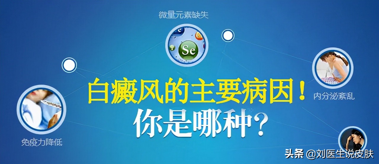 治疗白癜风不用愁！收好这份<就诊指南>，安全有效，祛白不走弯路