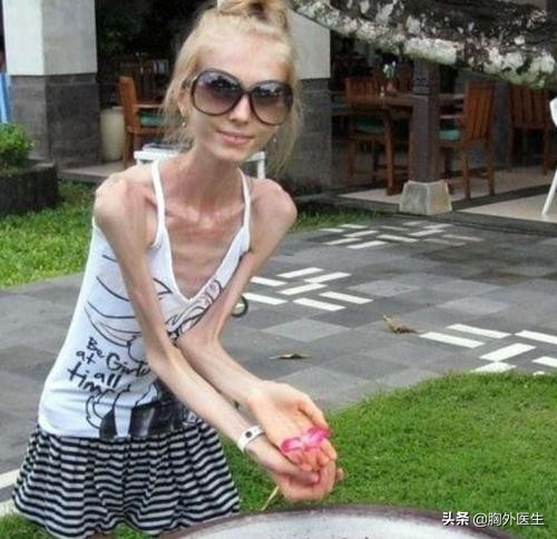 疯狂减肥危害大！人的标准体重是多少？医生教你计算方法