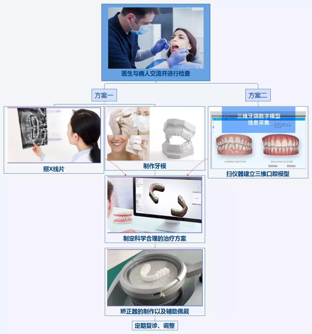 矫正牙齿，网上9.9的牙套靠谱吗？