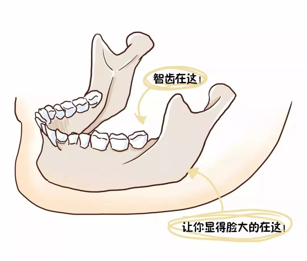 看着都疼！男子没钱拔智齿用电钻自己拔，导致半张脸瘫痪