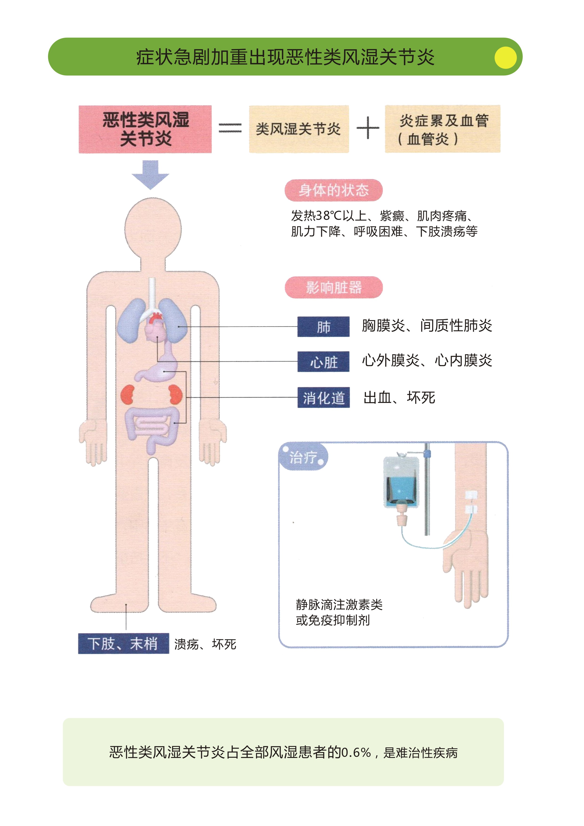 关节不痛了，为何类风湿因子和抗CCP还是高？是医生诊断错了吗？