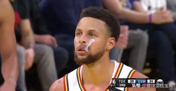 为什么nba球员带牙套(百思不得其解！不就打个篮球嘛，库里为什么要戴牙套？)